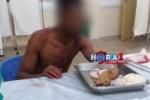 BARBÁRIE: Durante briga em bar homem tem o braço decepado com golpe de facão em Nova Mamoré