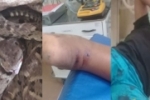 CUJUBIM: Criança picada de cobra morre por falta de antidoto em hospital, diz moradora em whatsapp