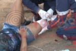 ARIQUEMES: Garota tem suspeita de fratura na perna ao sofrer acidente entre carro e moto na Taboca