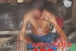 TENTATIVA DE HOMICÍDIO: Homem é agredido por desconhecido que queria droga em Alto Paraíso