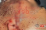 ARIQUEMES: Homem tem rosto dilacerado por golpe com caco de garrafa após ser atacado por travesti no Setor 10 – IMAGENS FORTES   